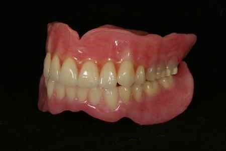 Permanent Dentures Procedure La Belle PA 15450